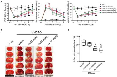 Ambroxol Upregulates Glucocerebrosidase Expression to Promote Neural Stem Cells Differentiation Into Neurons Through Wnt/β-Catenin Pathway After Ischemic Stroke